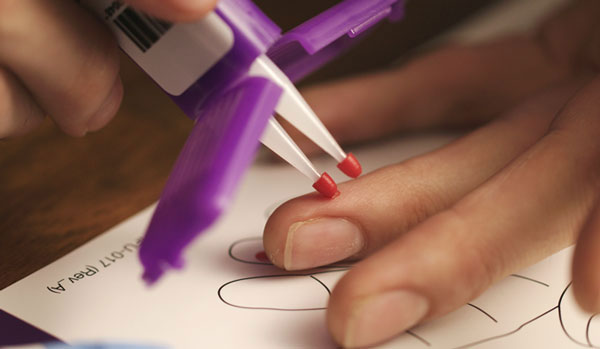 Success with Microsampling in Clinical Trials Live Discussion