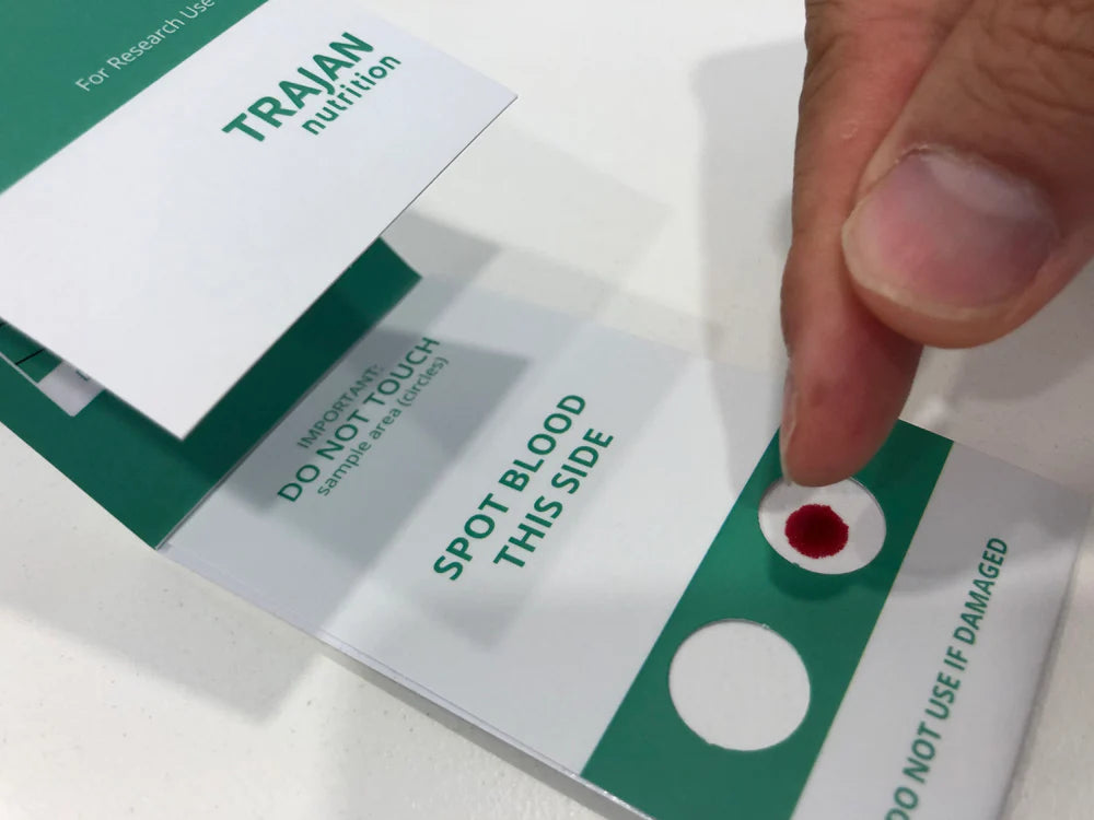 Blood spot tests set to replace costly vials