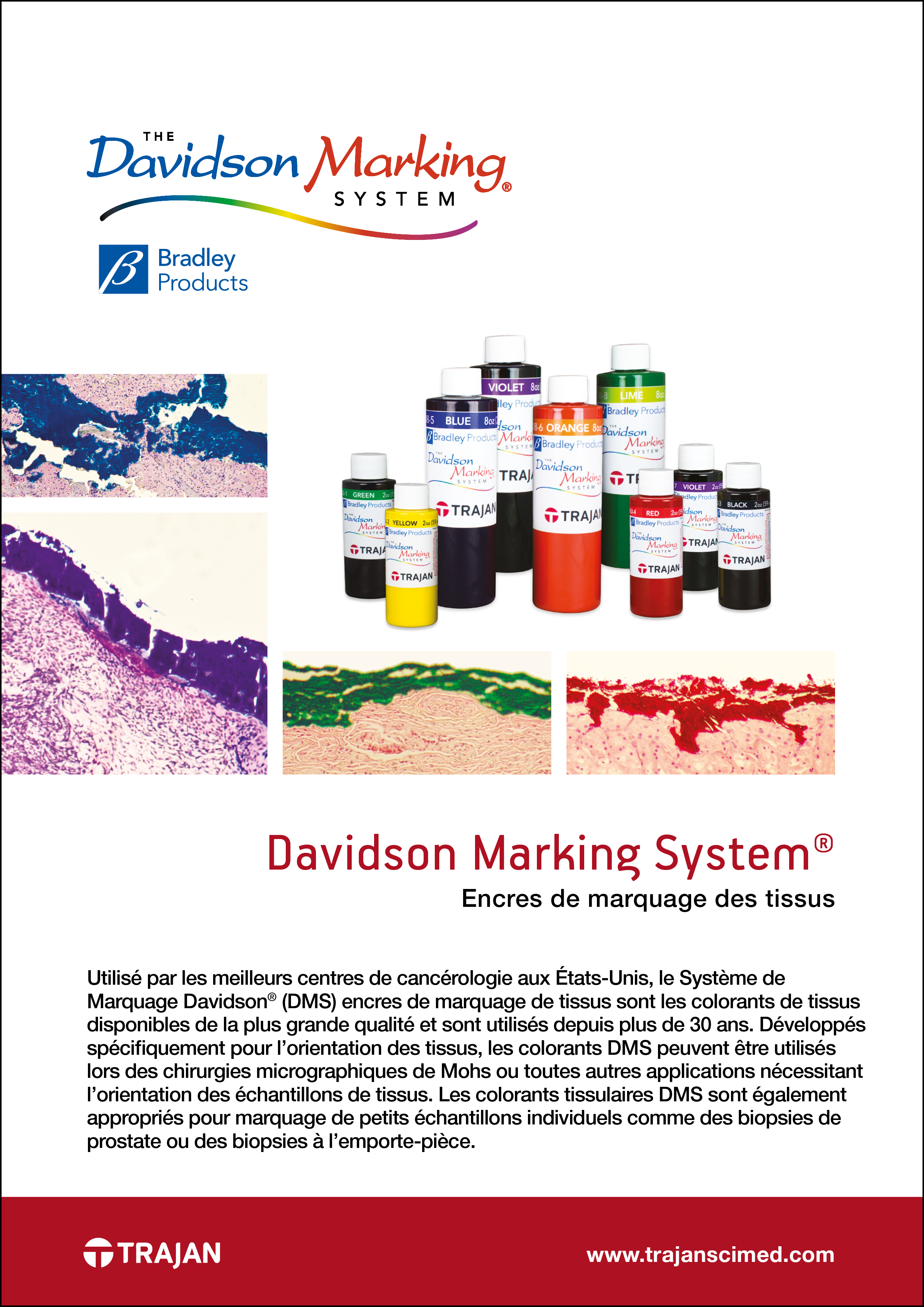 Brochure - Davidson Marking System (French)
